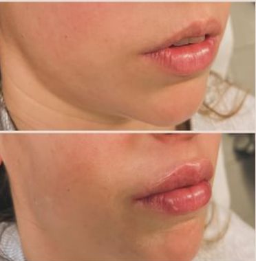 Sergio Conversano-17