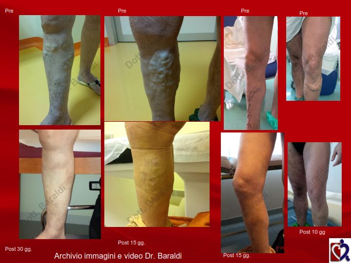 Christian Baraldi-17