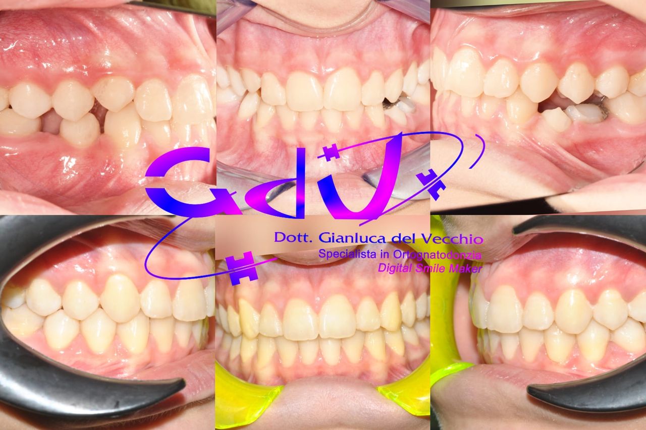 Gianluca Del Vecchio-183