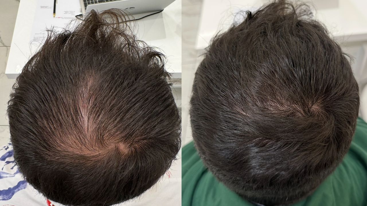 Dominika Starzomska-0