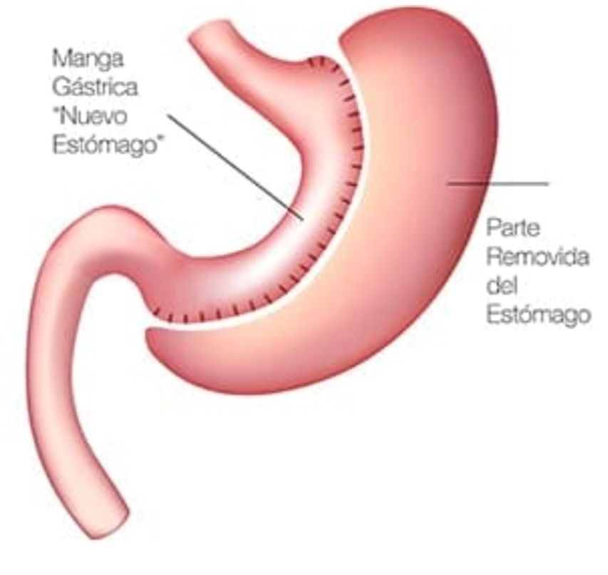 Virginia Gomez Cabeza De Vaca-2