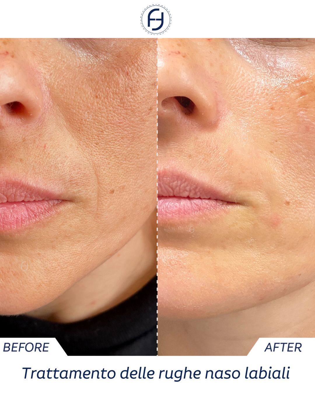 Francesca Flagiello-33