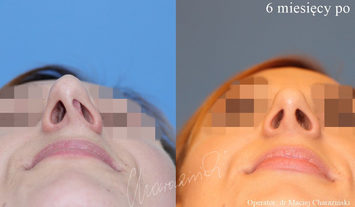 Maciej Charaziński-14