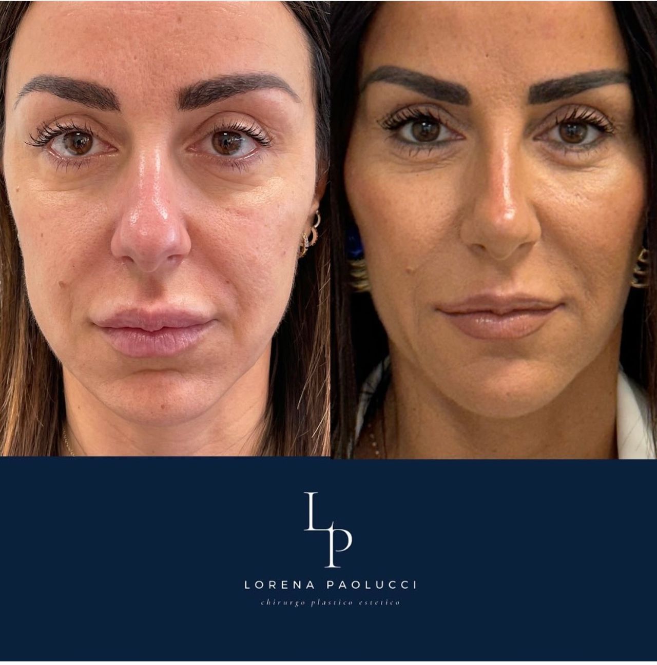 Lorena Paolucci-24