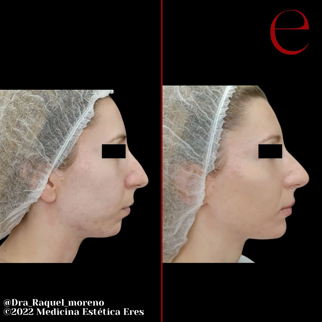 Raquel Moreno Pentinel-89