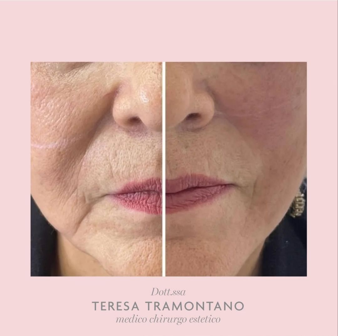 Teresa Tramontano-7