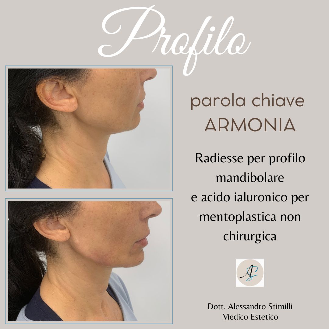 Alessandro Stimilli-10