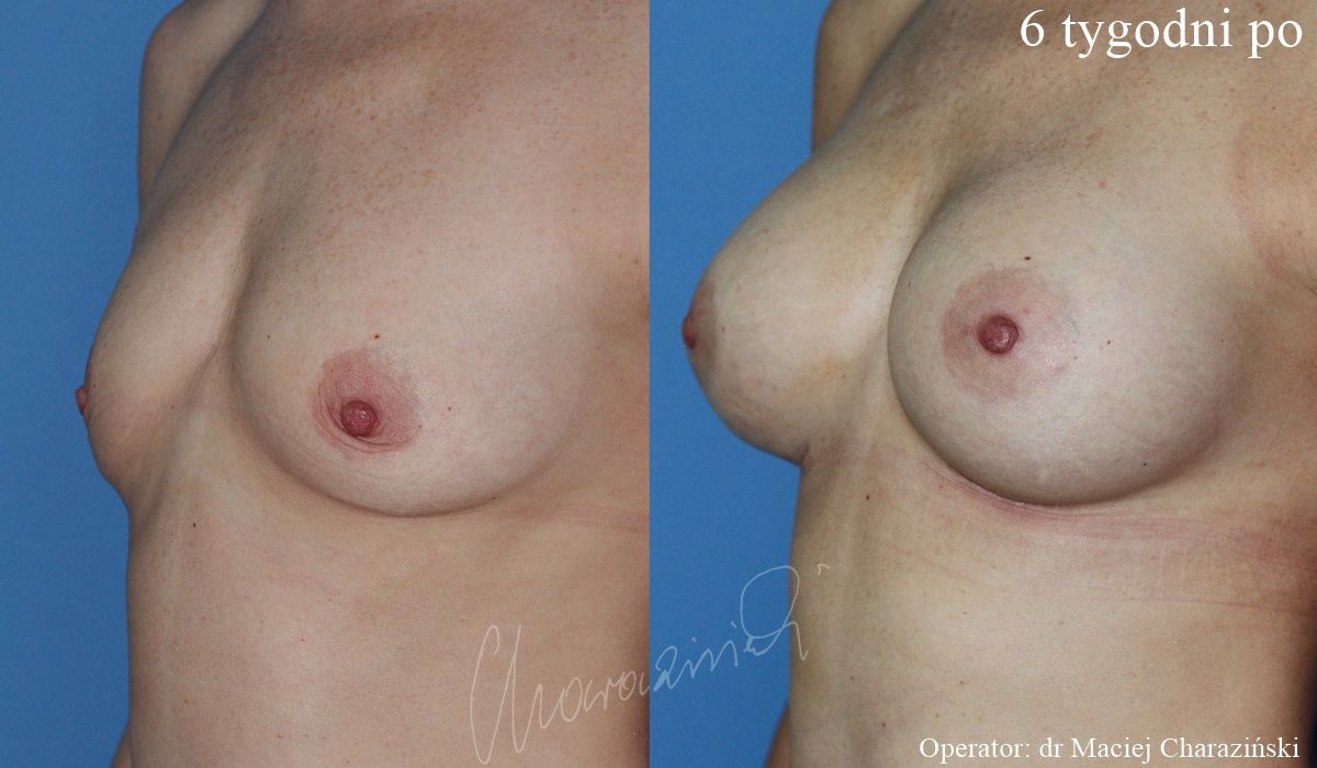 Maciej Charaziński-118