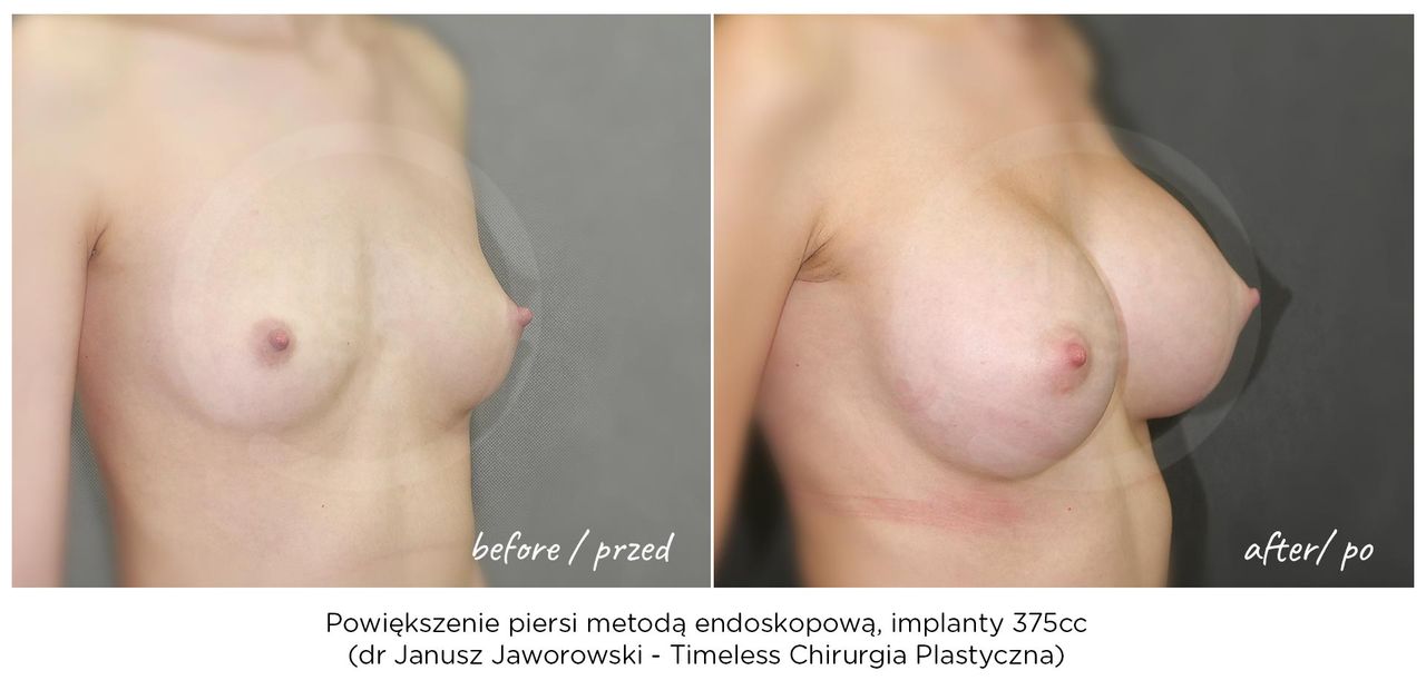 Janusz Jaworowski-126