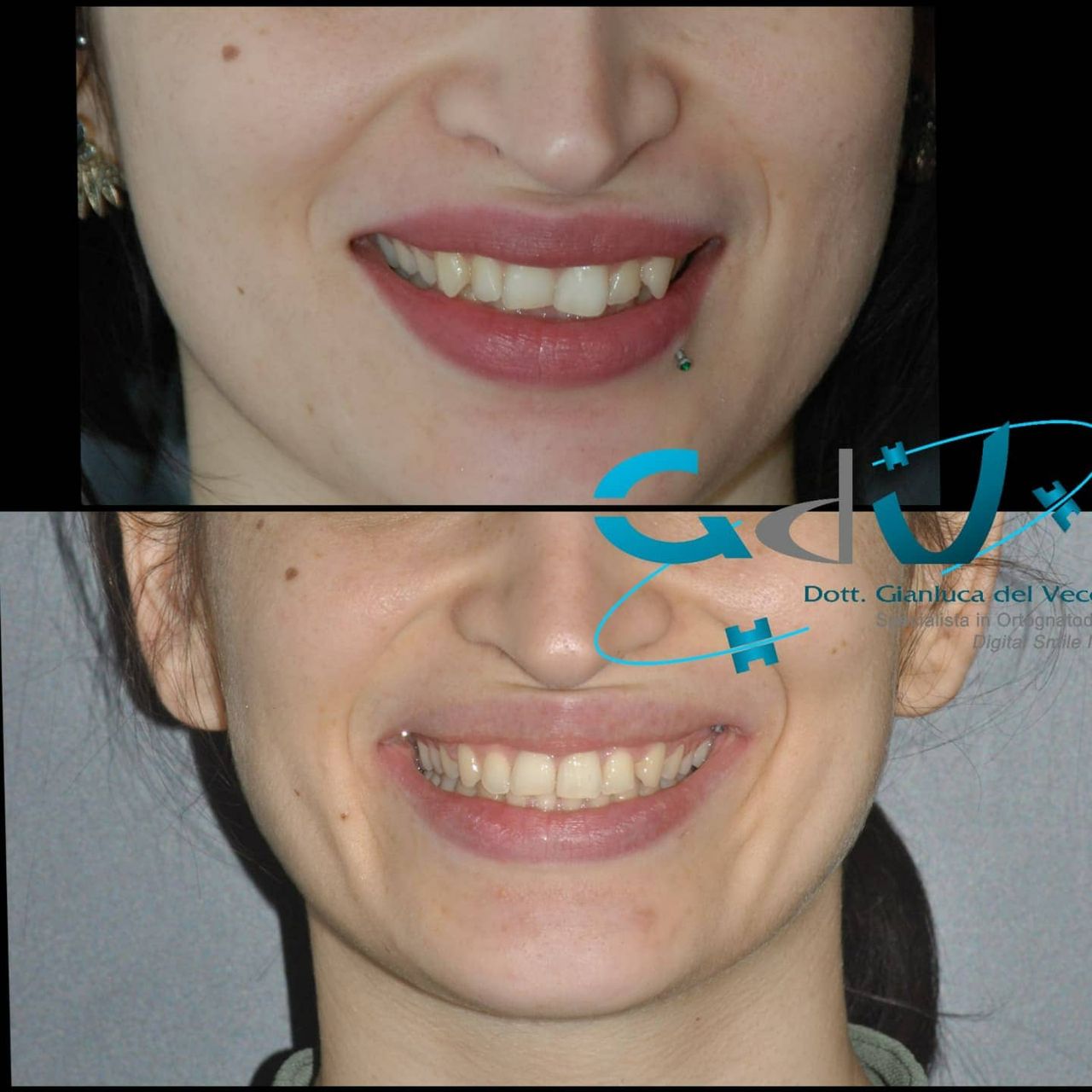 Gianluca Del Vecchio-131