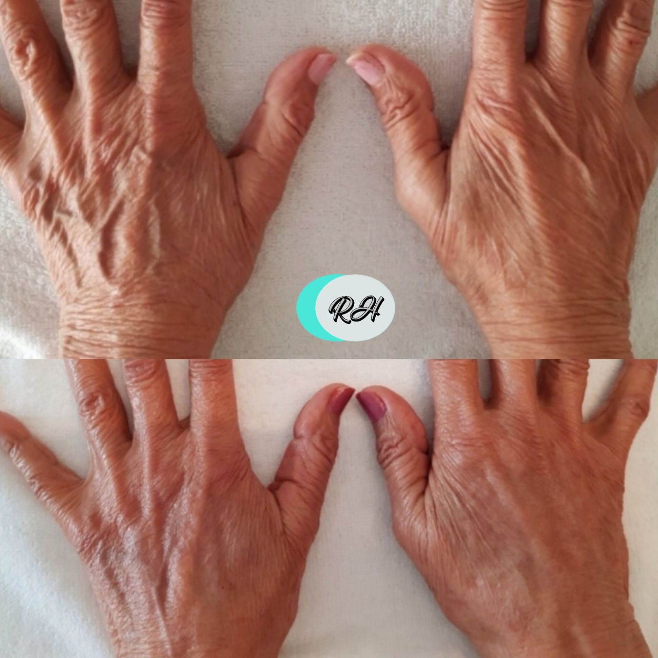 Rosalba Herrero Zerpa-99