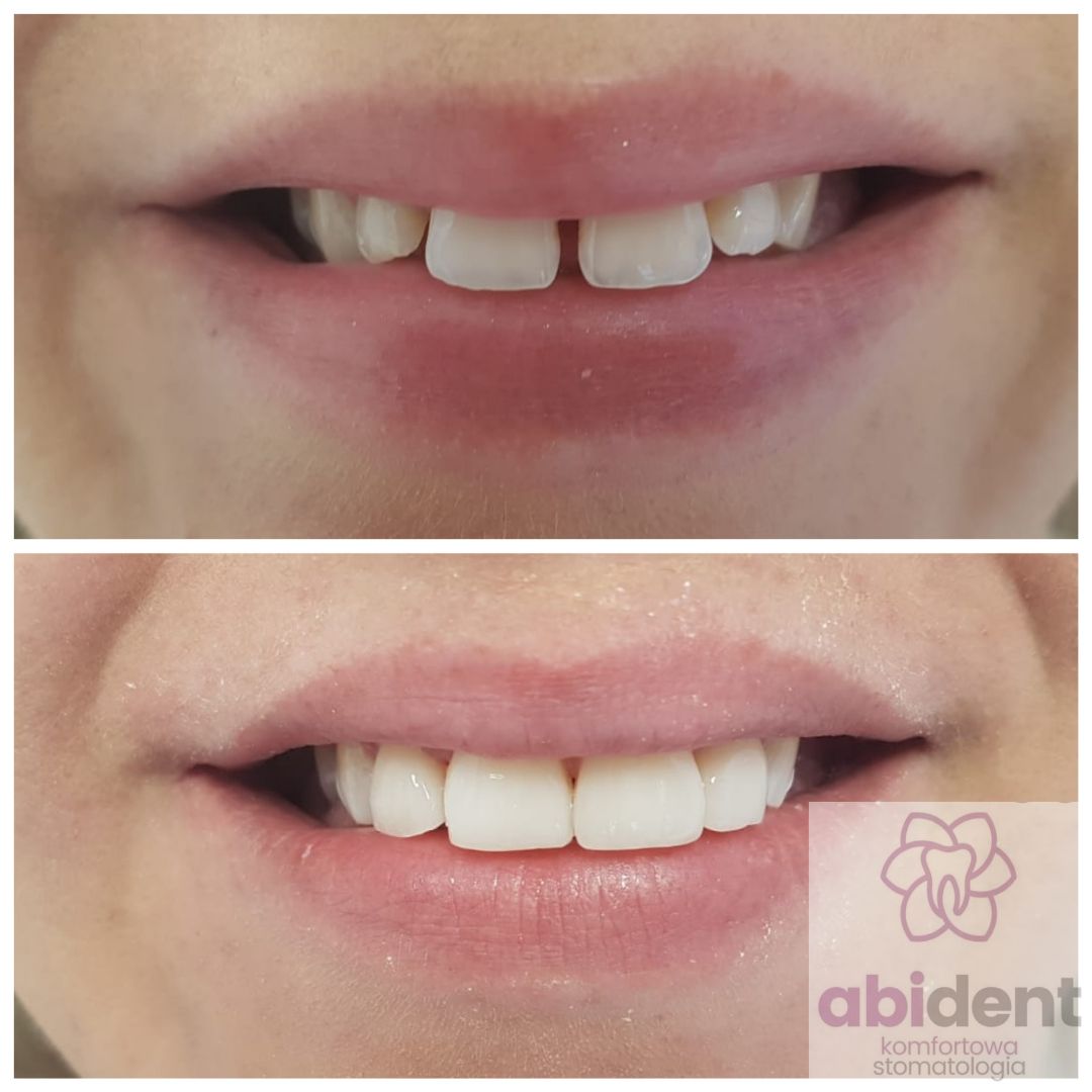 Katarzyna Korfanty-3