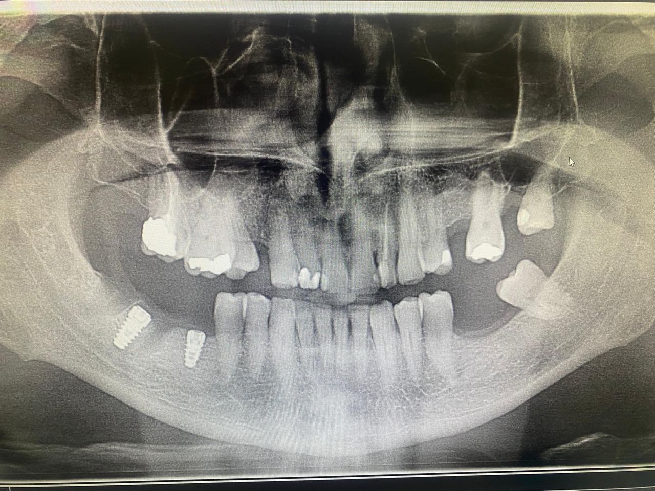 Luigi Giuseppe Romano-16