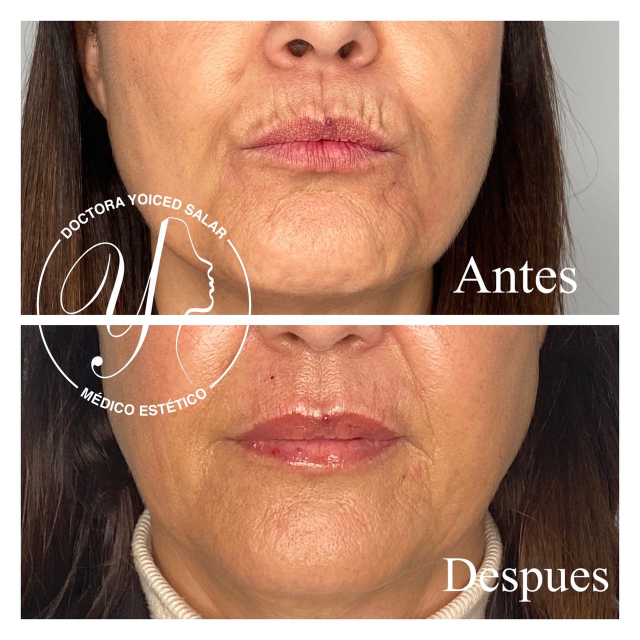 Yoiced Salar Peñate-9