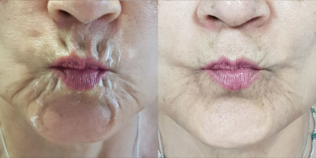 Rosalba Herrero Zerpa-60