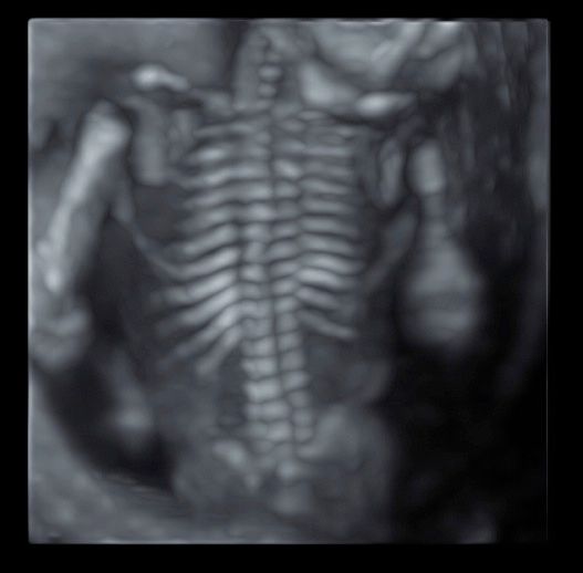 Tommaso Incandela-20