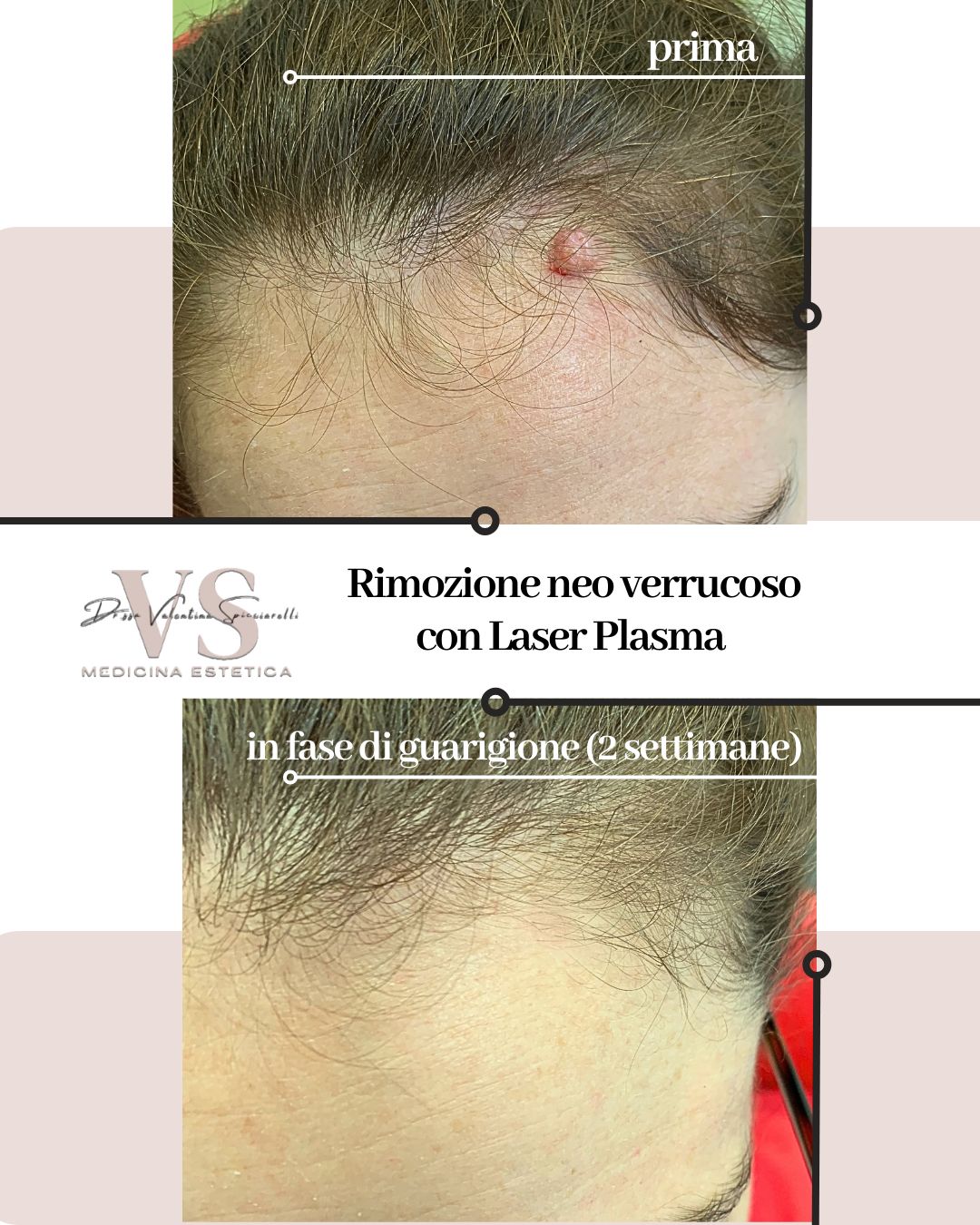 Valentina Spicciarelli-5