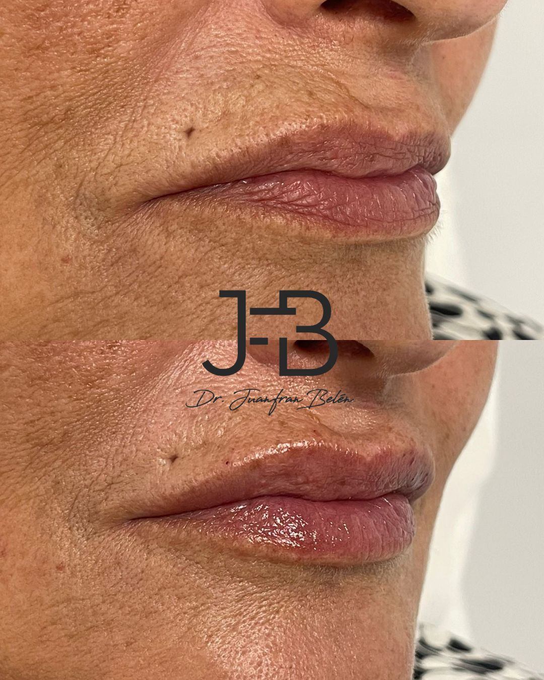 Juan Francisco Belén Montero-43