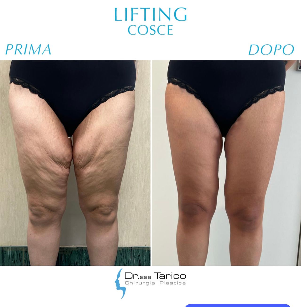 Maria Stella Tarico-12