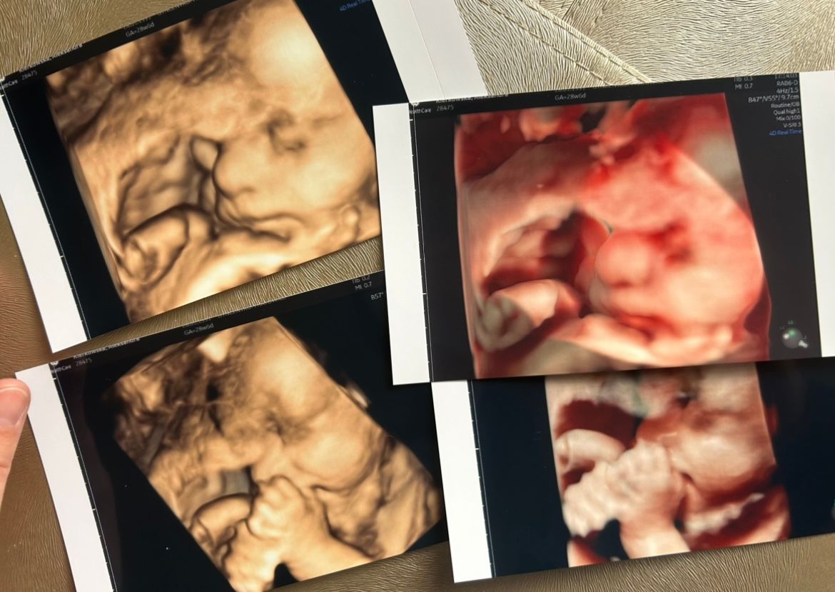 Wioletta Rozmus-Warcholińska-134