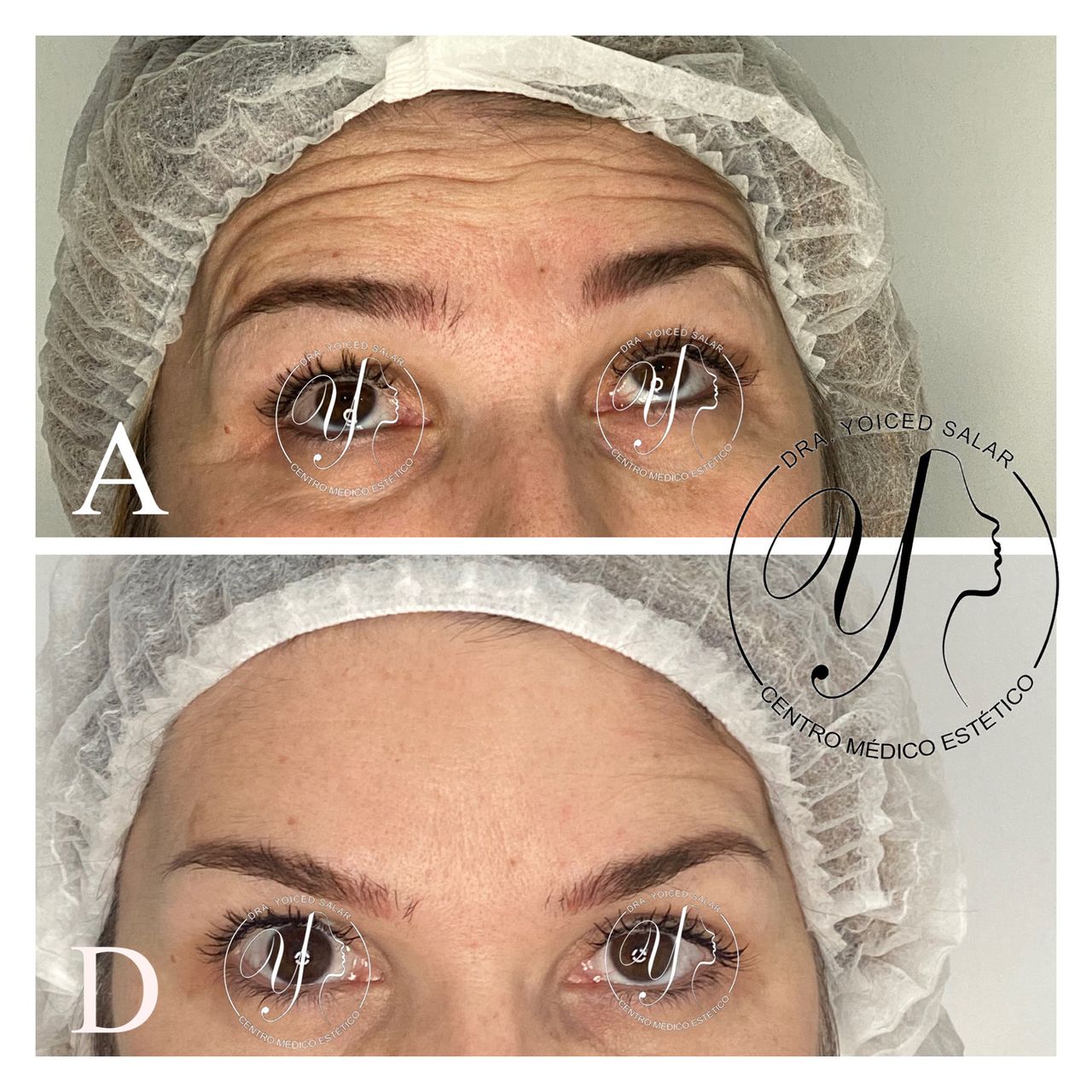 Yoiced Salar Peñate-19