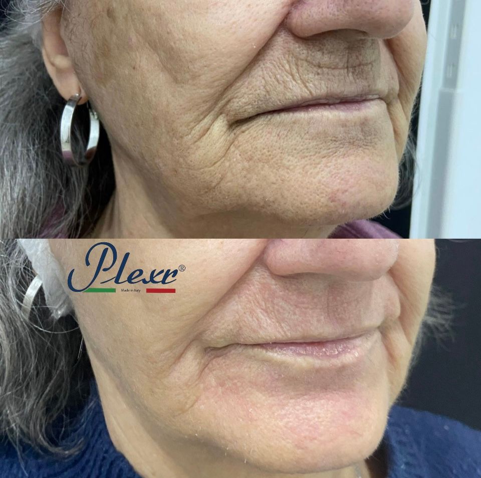 Raffaele Del Prete-15