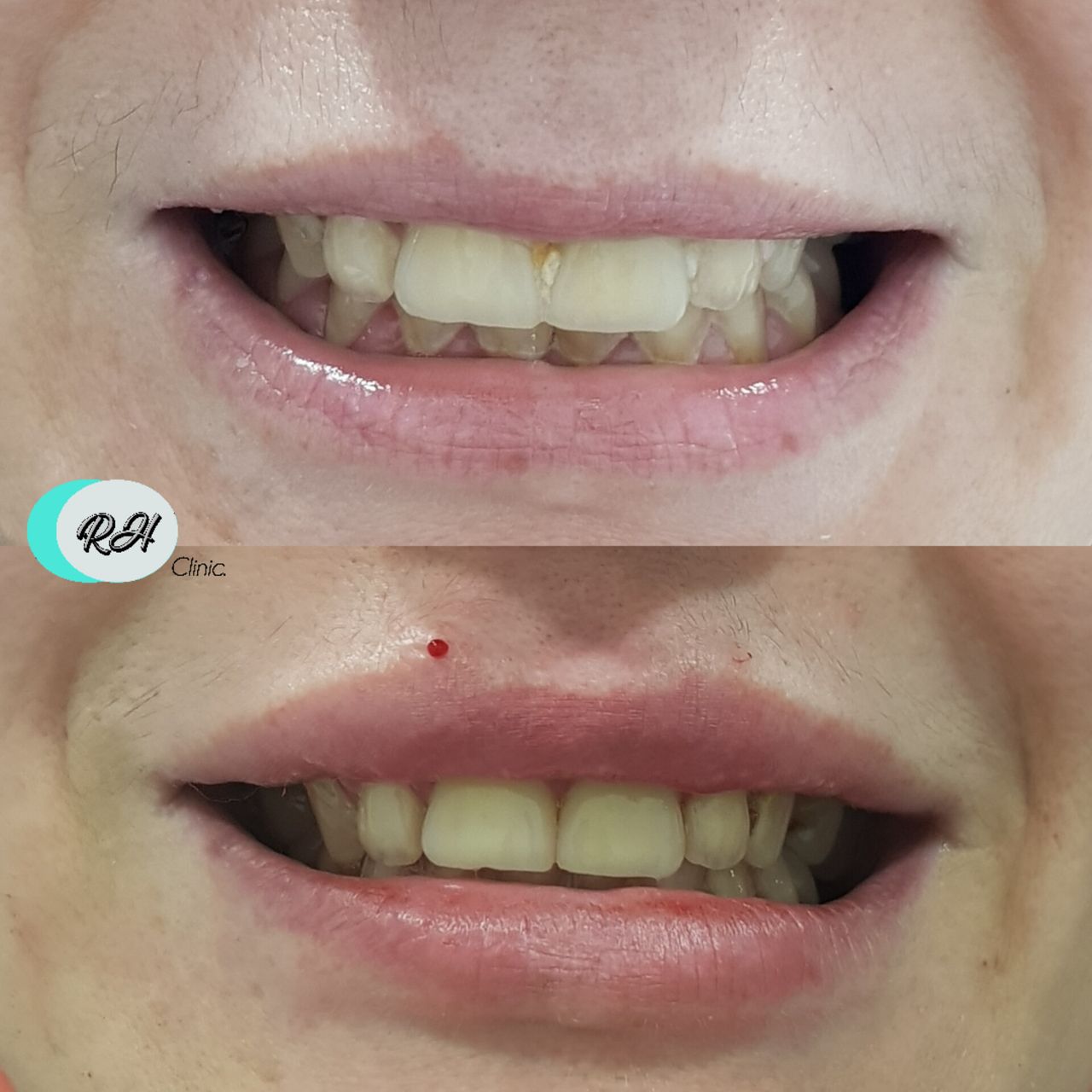 Rosalba Herrero Zerpa-81