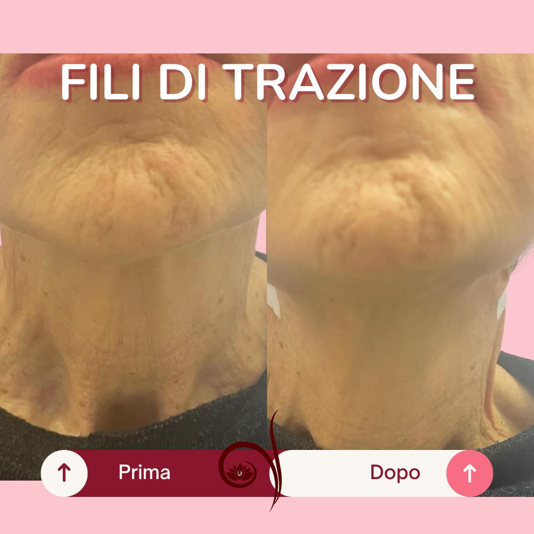 Vittoria Cassioli-32