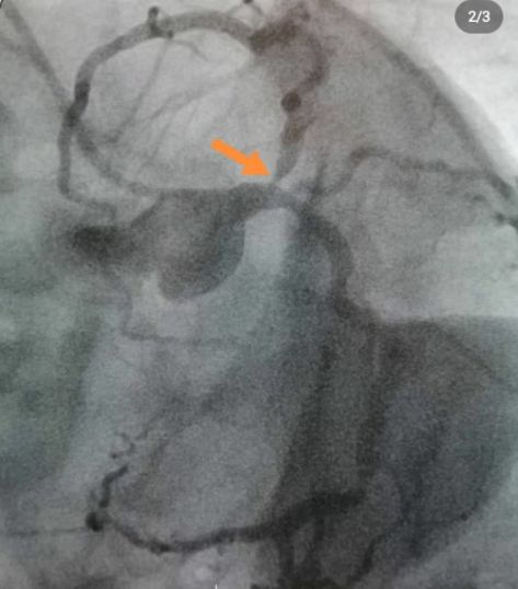 Hüseyin Onur Şahin-17