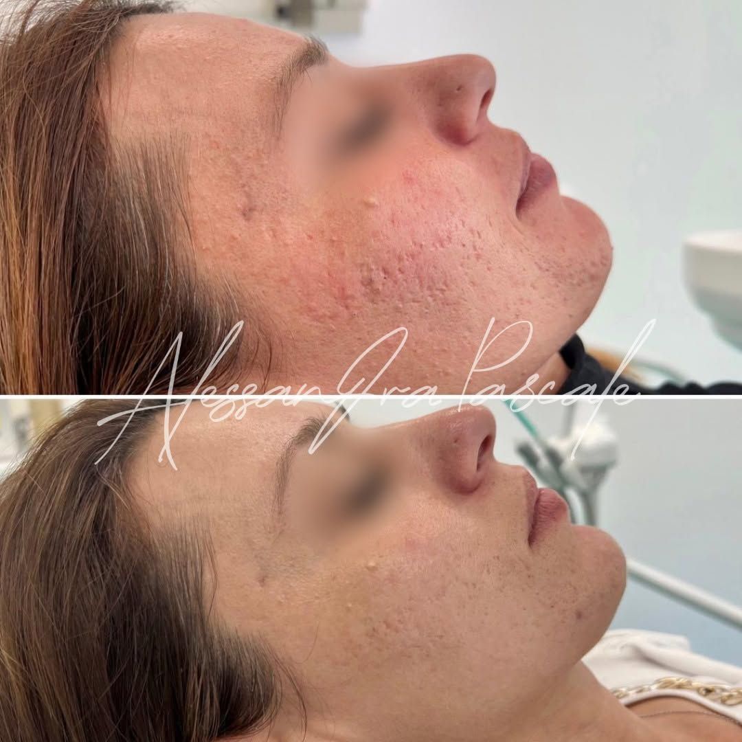 Alessandra Pascale-12