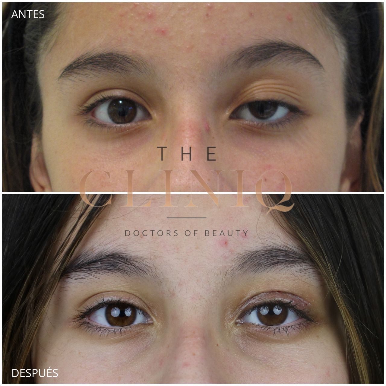 Ignacio Genol Saavedra-15