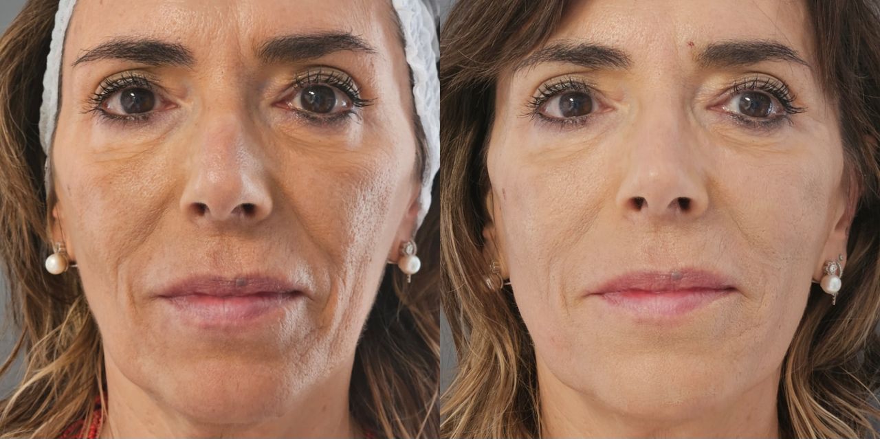 Rosalba Herrero Zerpa-35