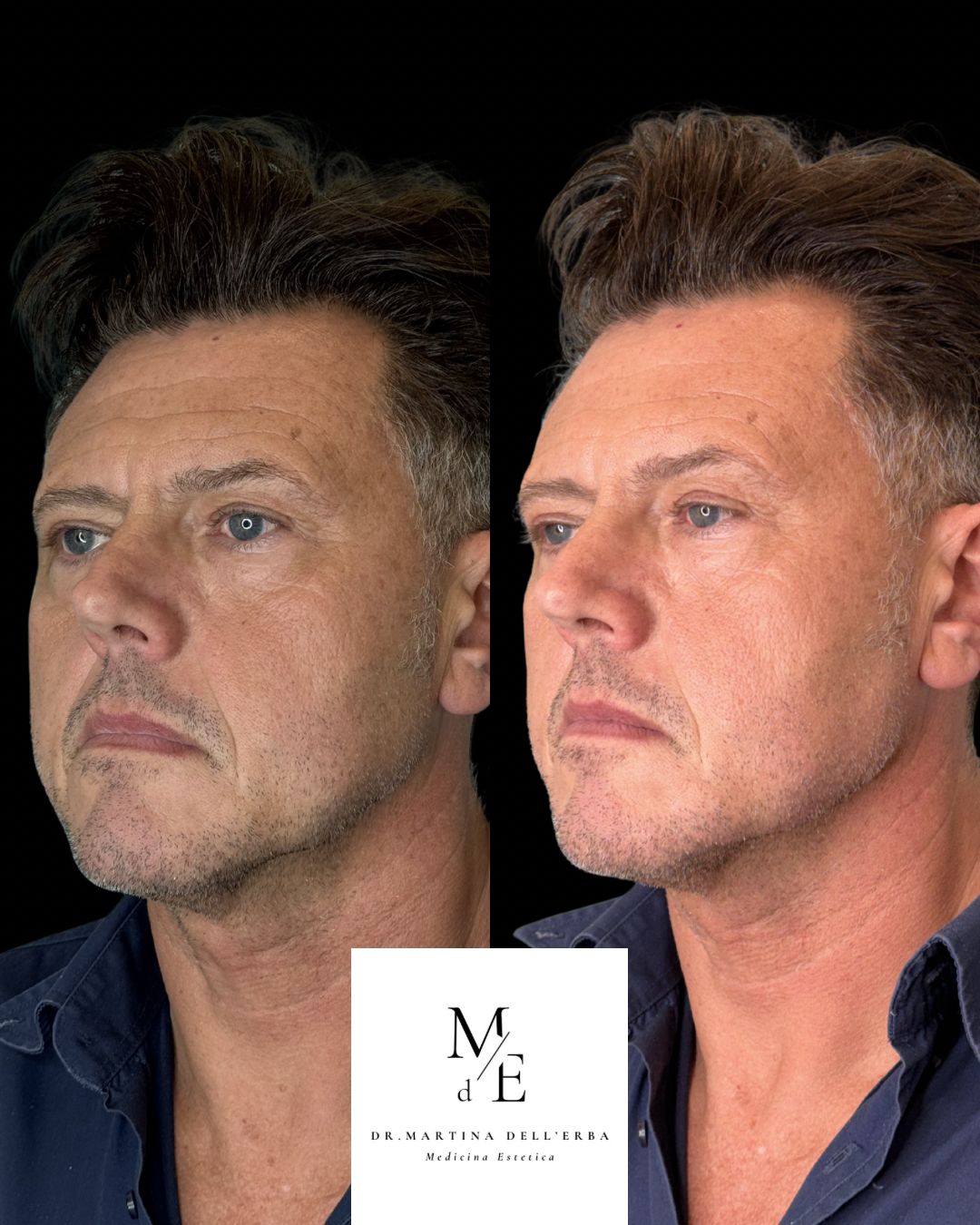 Martina Dell'erba-17