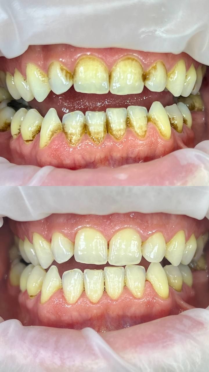 Tetiana Starodubets-4