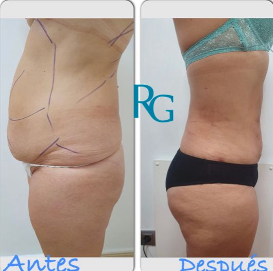 Rafael Gonzalez Oñate-12