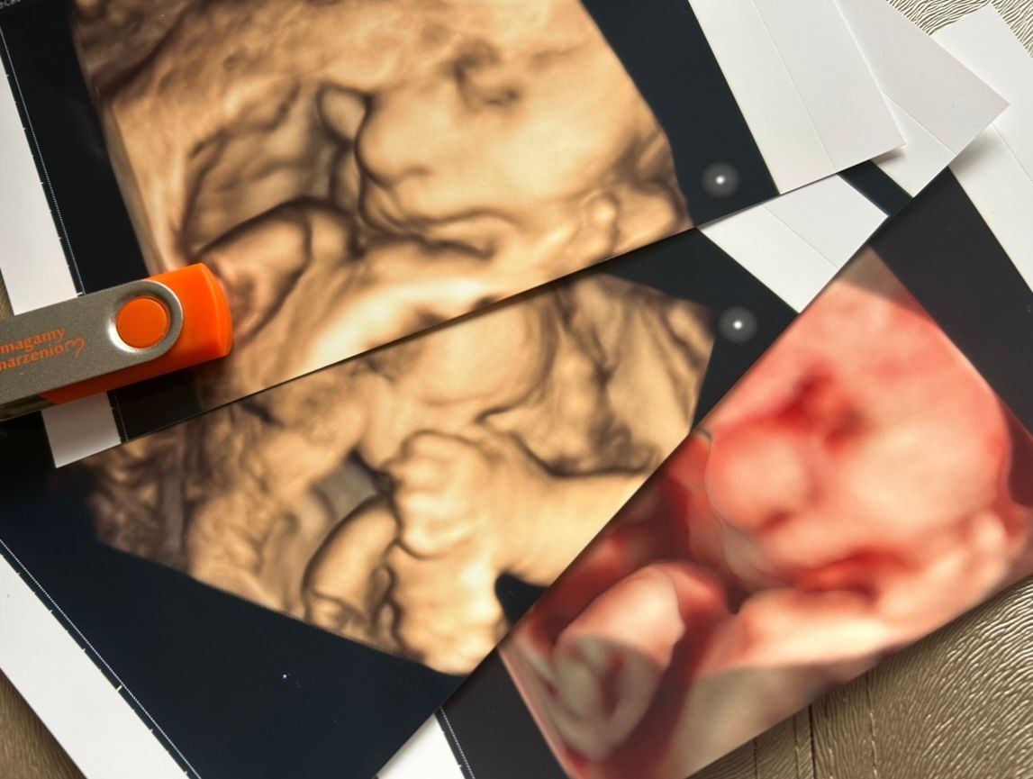 Wioletta Rozmus-Warcholińska-138