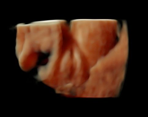 Tommaso Incandela-41