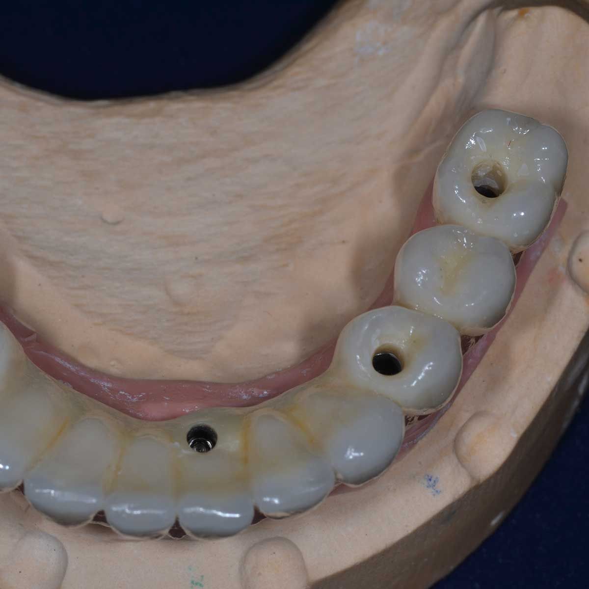 Gianluigi Bittante-74