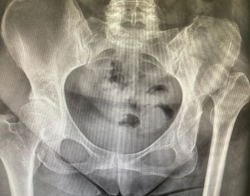 Nizamettin Güzel-17