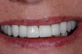 Zbigniew Mariusz Kapuściński-11