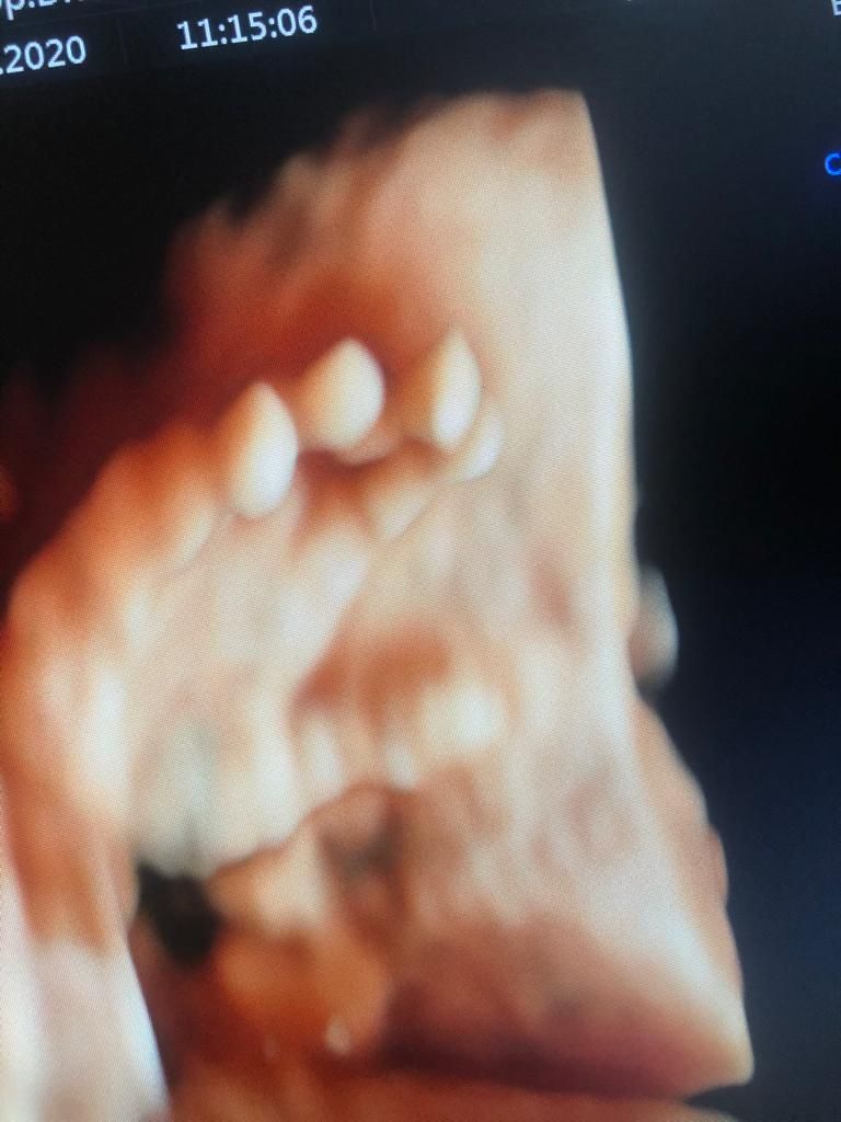 Dilek Turğut Kestane-19