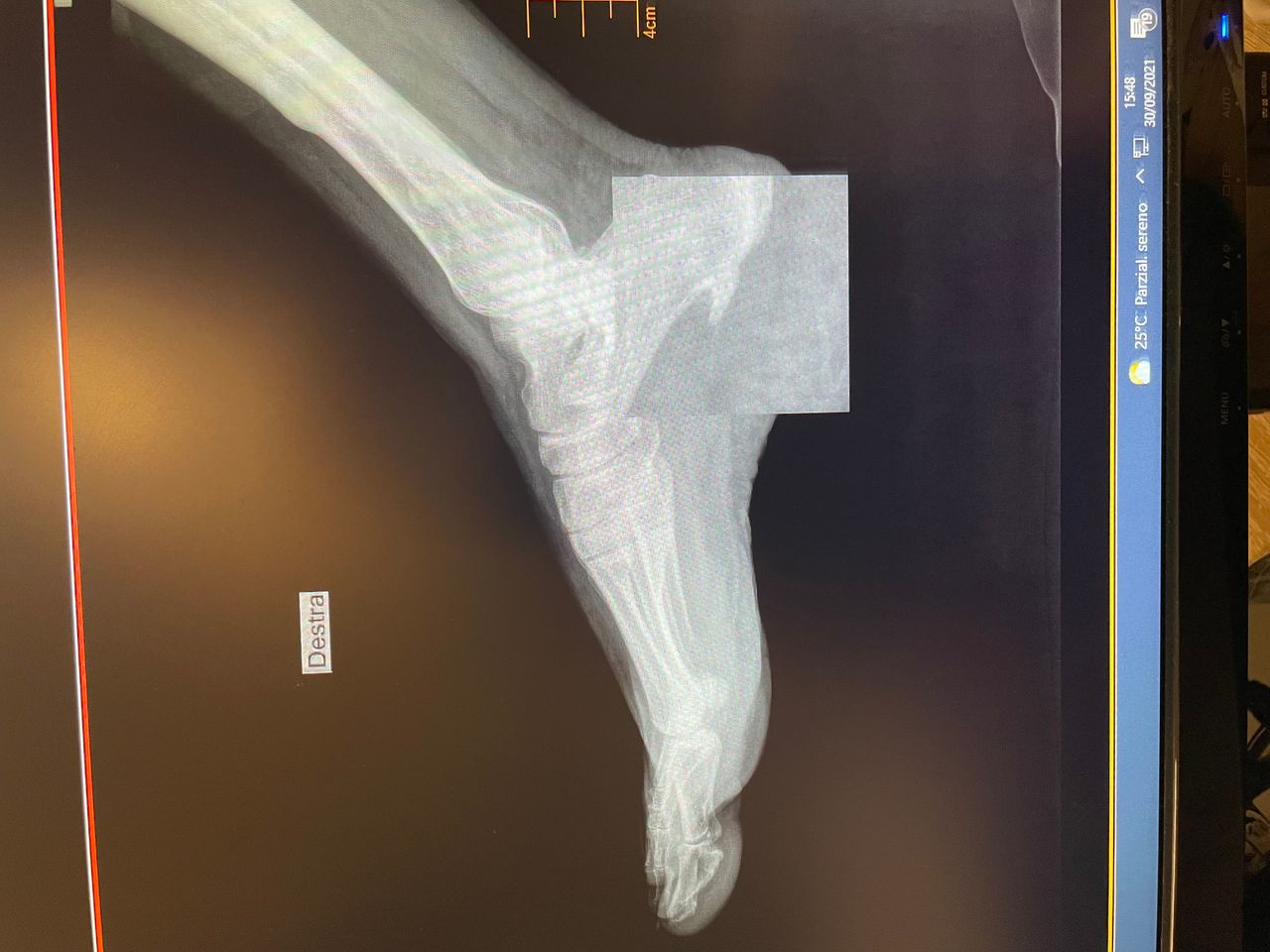 Giuseppe Lombardo-36