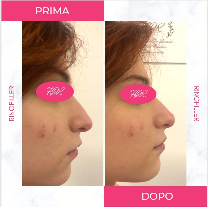 Francesca De Razza-55