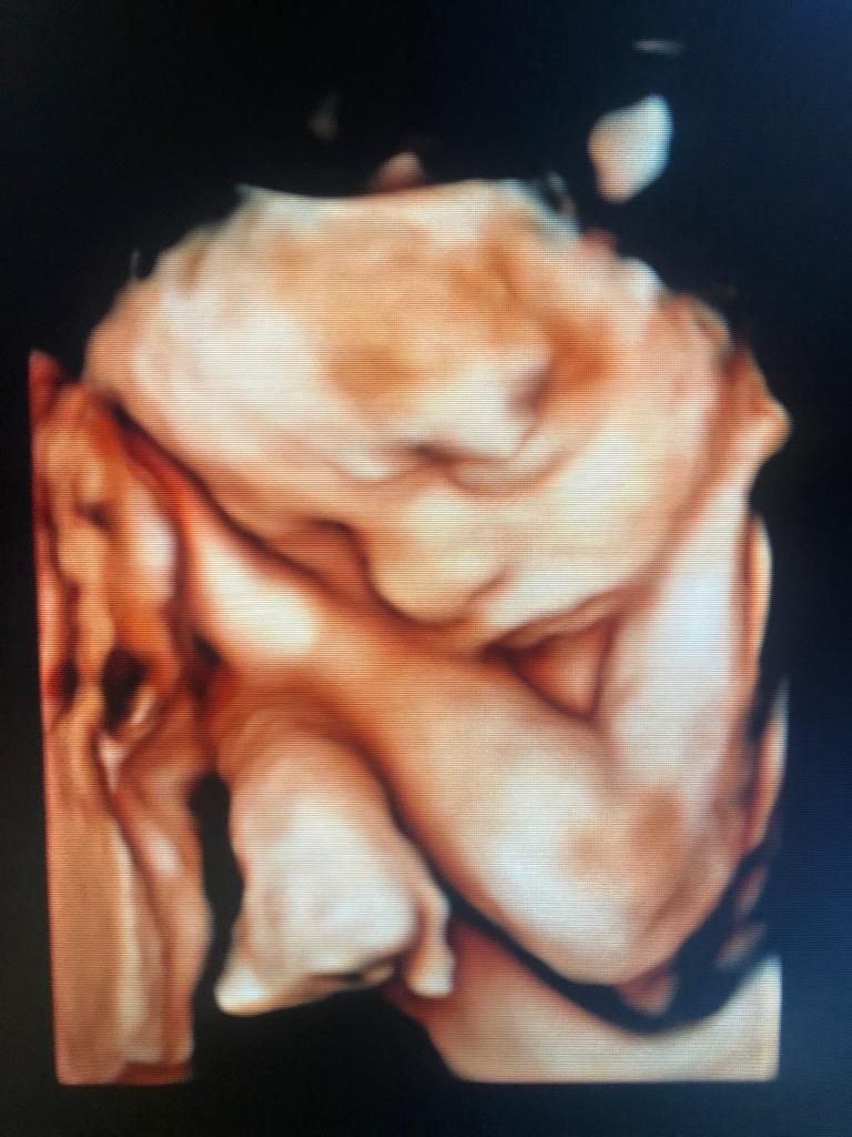 Dilek Turğut Kestane-12