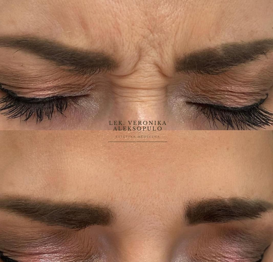 Veronika Aleksopulo-0