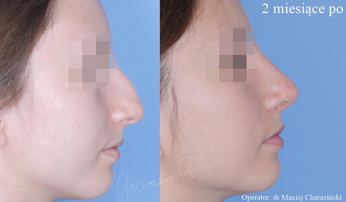 Maciej Charaziński-3