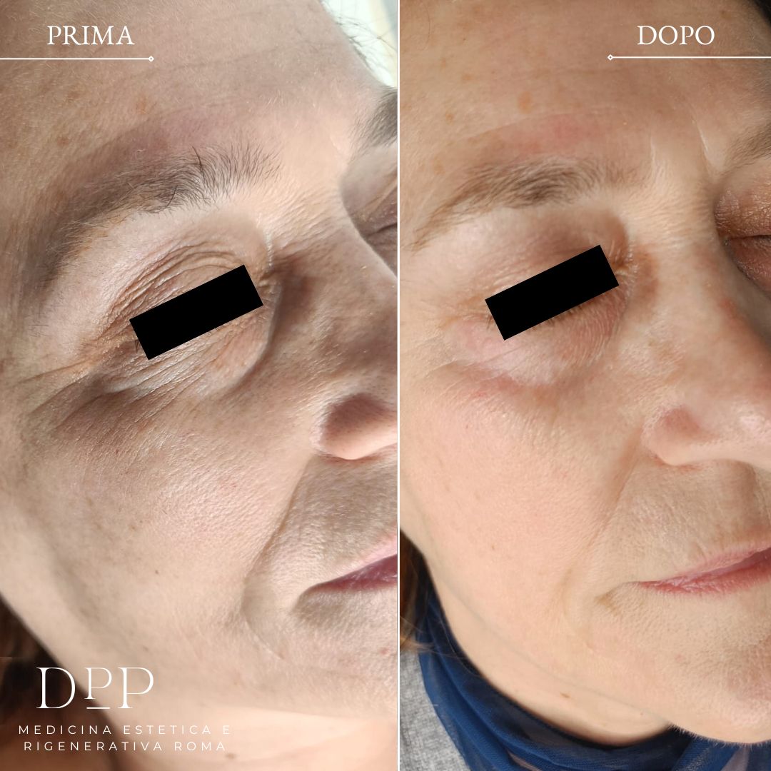 Davide Prosperi Porta-2