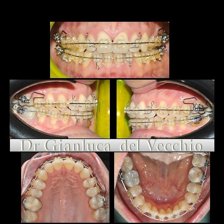 Gianluca Del Vecchio-43