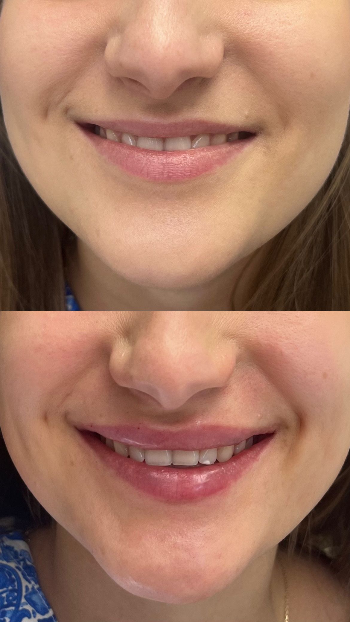 Adrianna Kostrzewa-4