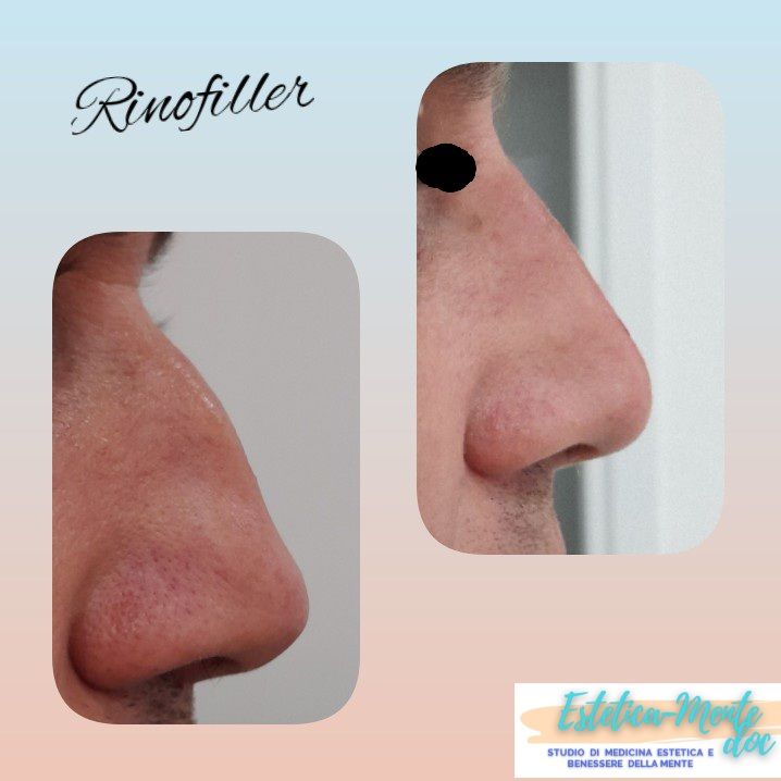 Paola Della Rocca-45